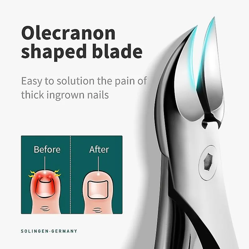 Yellow Suit Nail Clippers Ingrown Toenail Cutters Pedicure Tools Anti-Splash Olecran Podiatry Paronychia Correction Manicure Tool Fa1207